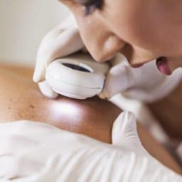 Doctor examining patient for signs of skin cancer