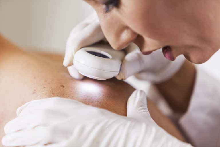 Doctor examining patient for signs of skin cancer